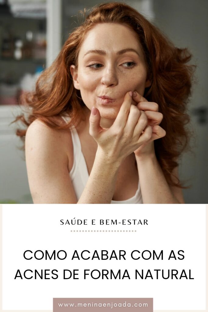 Como acabar com as acnes de forma natural